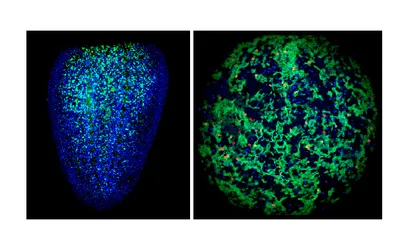 Planarian stem cells in adult and embryo