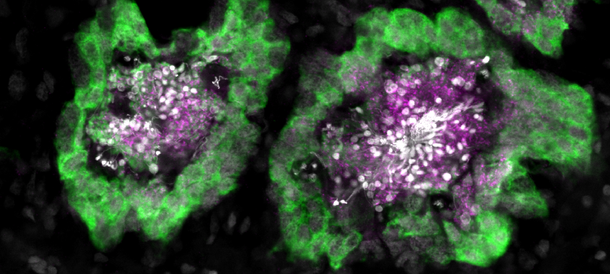 Planarian research microscopy
